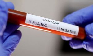 SAĞLIK BAKANLIĞI PCR TEST ÜCRETİNİ AÇIKLADI