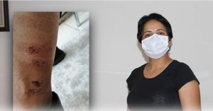 EPİLASYON REZALETİ