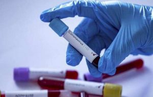 ANTALYA VALİLİĞİNDEN ZORUNLU PCR TEST KARARI