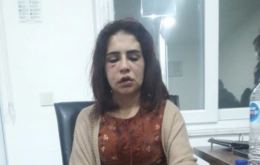 ÖLMEK İSTEMEYEN KIZIN FERYADI