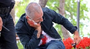 KANALLARA ÇIKMAK İÇİN BOĞAZINI KESTİ