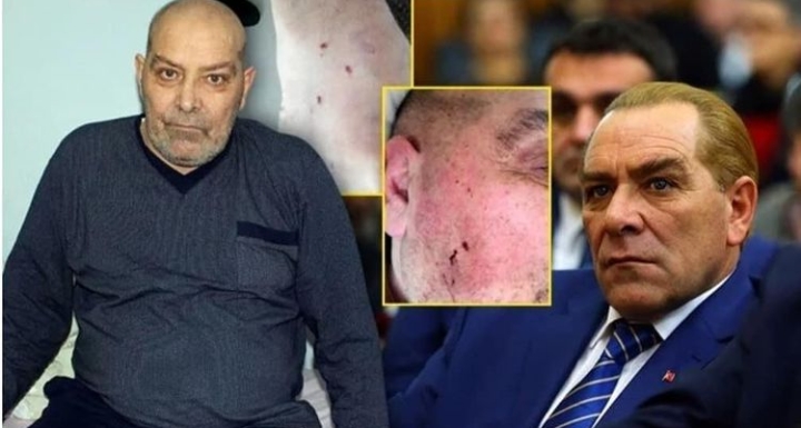 ŞİDDET GÖRDÜĞÜ EŞİNDEN ŞİKAYETÇİ OLDU