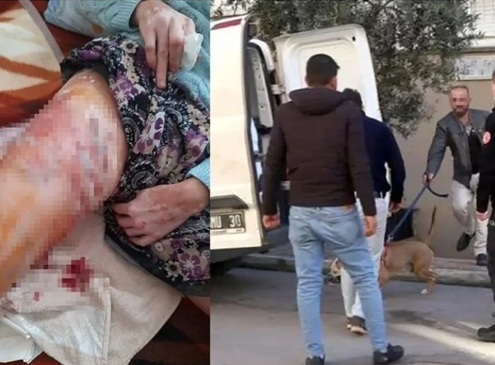 ANTALYA’DA PİTBULL SALDIRISI