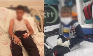 KÖPEĞİN ISIRDIĞI ÇOCUKTAN KÖTÜ HABER