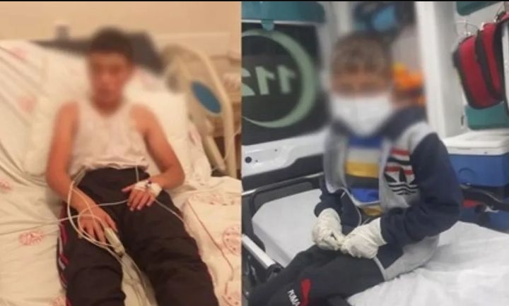 KÖPEĞİN ISIRDIĞI ÇOCUKTAN KÖTÜ HABER