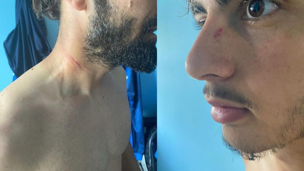 KESTELSPOR’A JİLETLİ, BIÇAKLI SALDIRI