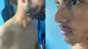 KESTELSPOR’A JİLETLİ, BIÇAKLI SALDIRI